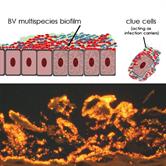 Bacterial Vaginosis; a Model of True Polymicrobial Infections: Genetics